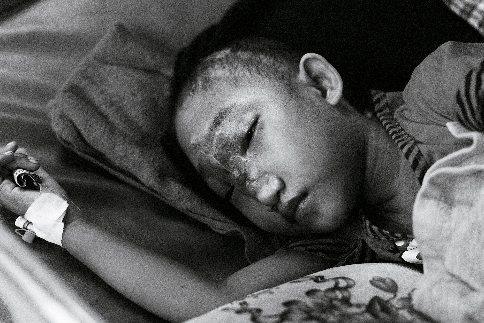 A boy rests on a pillow with his eyes closed.